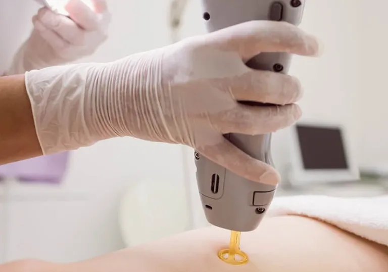 Laser Treatments in AL Nahda Dubai